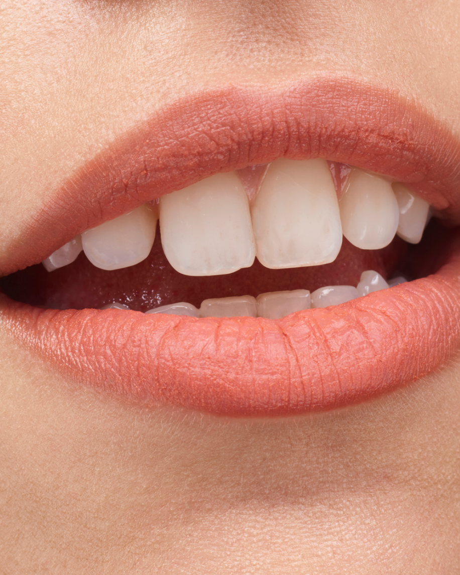 Update 118+ glossier cake best in.eteachers